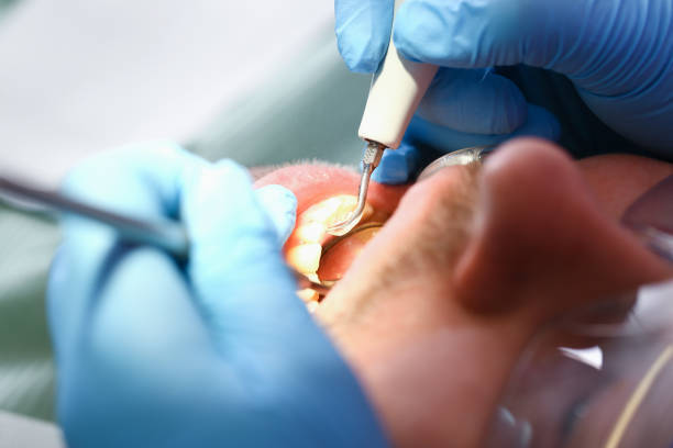 Best Emergency Dental Care for Broken or Chipped Teeth in Hayfork, CA